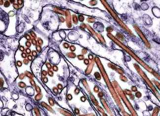 Health Care Worker Exposed to Bird Flu: Symptoms and Unknowns news-05102024-220651