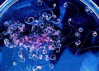 Can Parasitic Worms Transmit Viruses and Cause Diseases? news-11102024-053447