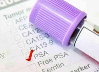 Prostate Cancer Test Reduces Deaths: Charity Urges Change news-14102024-150013