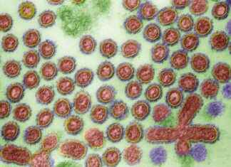 Developing a Timely H5N1 Bird Flu Vaccine: Will It Arrive in Time? news-31102024-023509