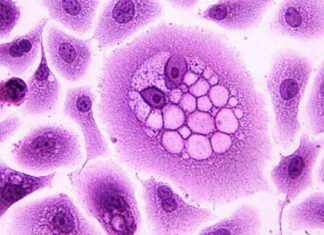 Can Viruses Lead to Cancer? news-03112024-144246