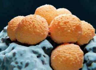 Understanding Necrotizing Fasciitis: Symptoms, Causes, and Treatment news-14112024-165123