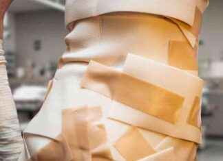 Butterfly Disease: Understanding the Skin Disorder with Fragile Wings news-21112024-173908