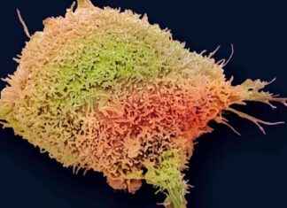 Cervical Cancer Deaths Decline in Young Women: US Study Results news-28112024-051339