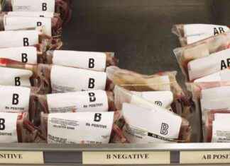 Understanding Blood Types: A Comprehensive Guide news-29112024-233834