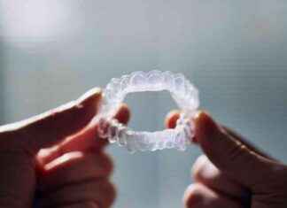 Is Excessive Teeth Whitening Bad for Your Oral Health? news-02122024-215204