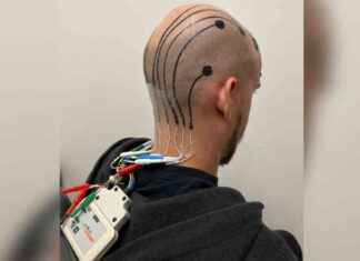 Next Big Thing: Electronic Scalp Tattoos for Brain Monitoring news-02122024-215403