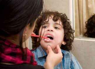 The Benefits of Fluoride in Preventing Cavities: A Comprehensive Guide the-benefits-of-fluoride-in-preventing-cavities-a-comprehensive-guide