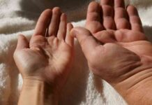 understanding-acromegaly-symptoms-causes-and-treatment-options
