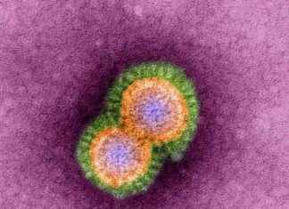 First Human Bird Flu Death in U.S.: Should You Be Worried? first-human-bird-flu-death-in-us-should-you-be-worried