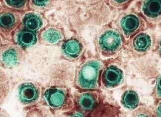 Herpes Virus and Brain Health: Link Between Concussions and Dementia herpes-virus-and-brain-health-link-between-concussions-and-dementia