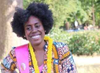 Sickle Cell Treatment Offered to NHS Patients for First Time sickle-cell-treatment-offered-to-nhs-patients-for-first-time