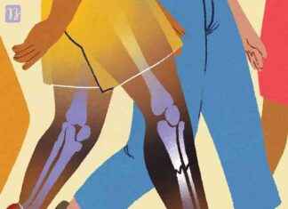 Walking on Broken Legs and Ankles for Faster Healing walking-on-broken-legs-and-ankles-for-faster-healing