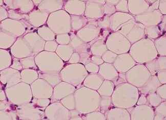 Discovery: New Type of Belly Fat Identified in Humans discovery-new-type-of-belly-fat-dentified-in-humans