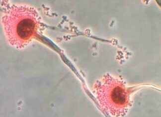 Fungal Disease Threatens UK Due to Climate Change fungal-disease-threatens-uk-due-to-climate-change